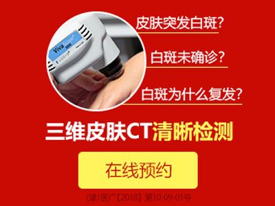 兰州治疗白癜风的医院?防护白癜风的比较常见的措施是什么?